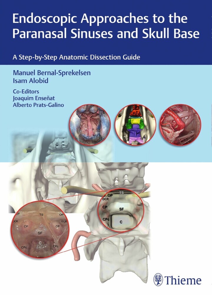 Endoscopic Approaches to the Paranasal Sinuses and Skull Base main product photo