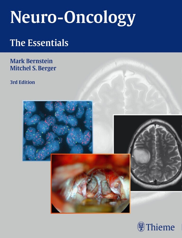 Neuro-Oncology: The Essentials main product photo