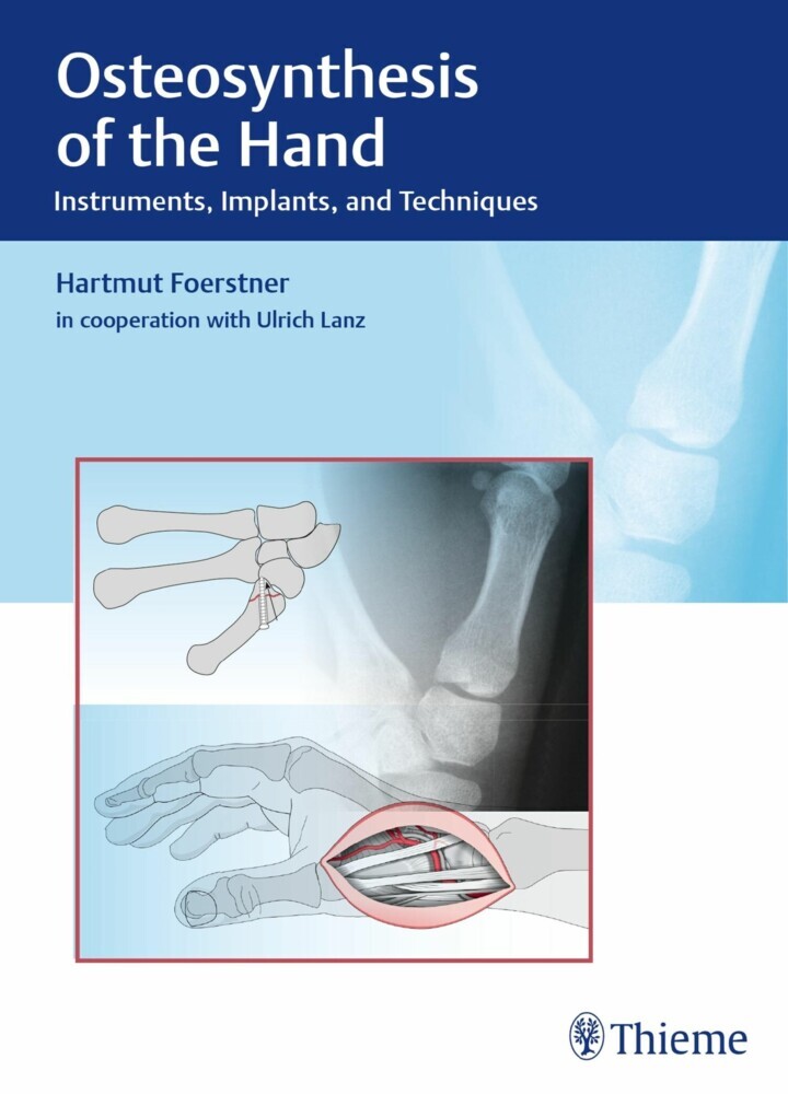 Osteosynthesis of the Hand main product photo