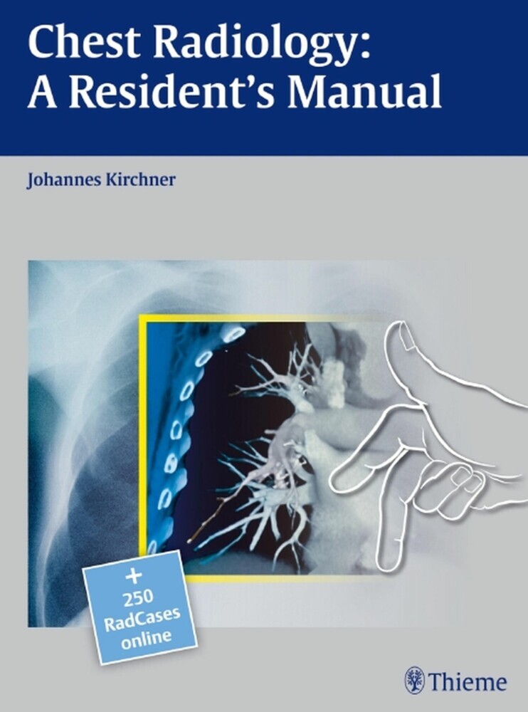 Chest Radiology: A Resident's Manual main product photo