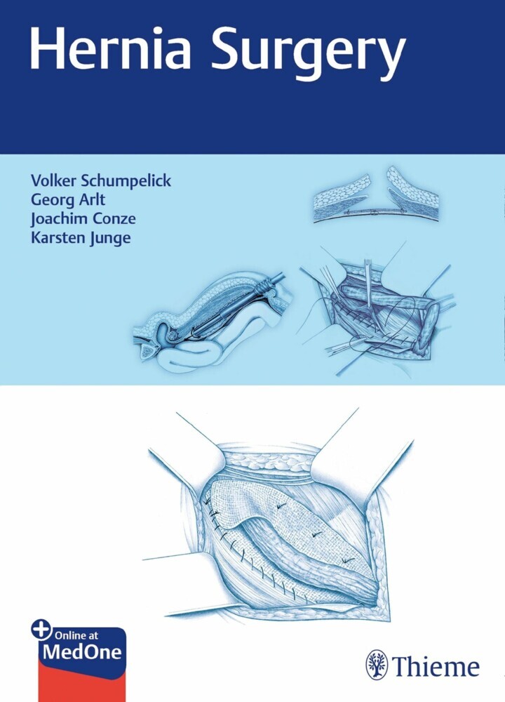 Hernia Surgery main product photo