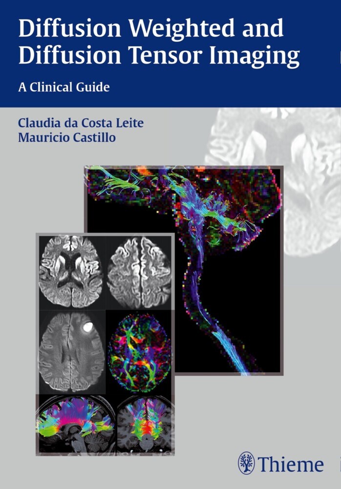 Diffusion Weighted and Diffusion Tensor Imaging main product photo