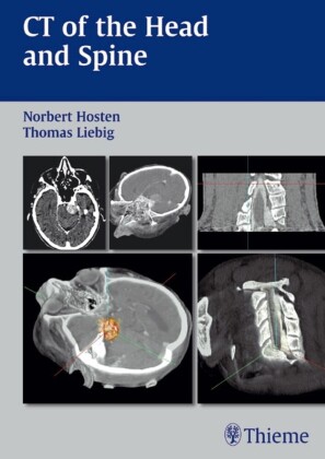 CT of the Head and Spine