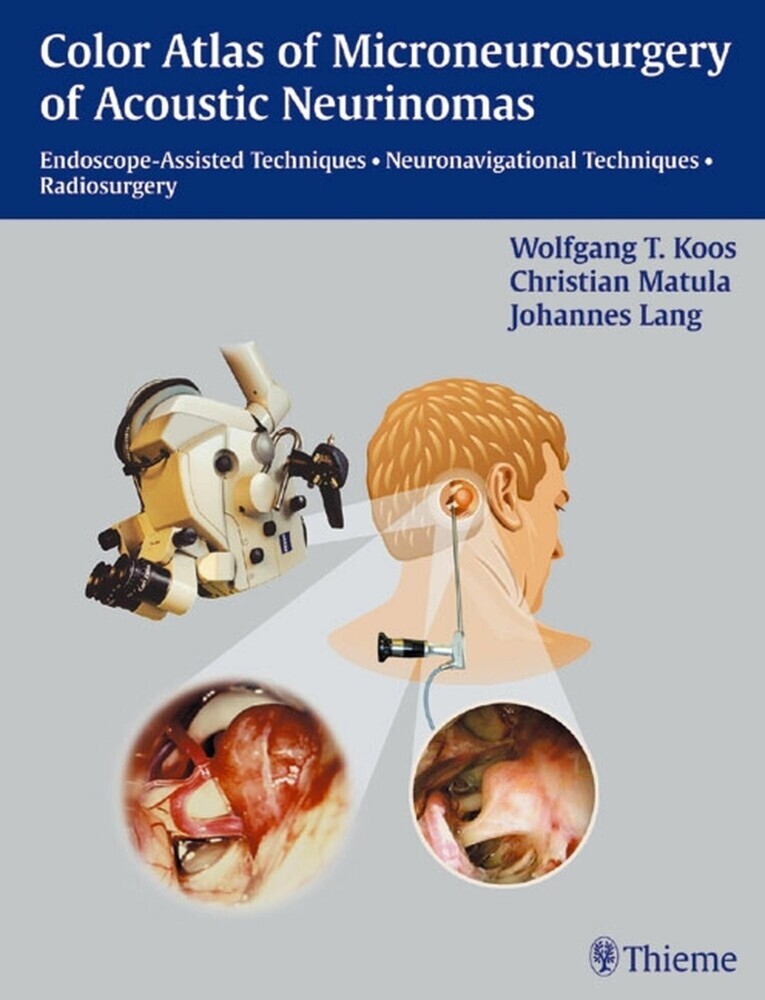 Color Atlas of Microsurgery of Acoustic Neurinomas main product photo