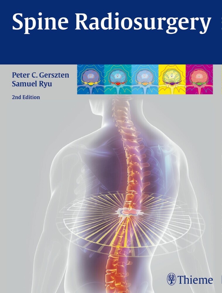 Spine Radiosurgery main product photo