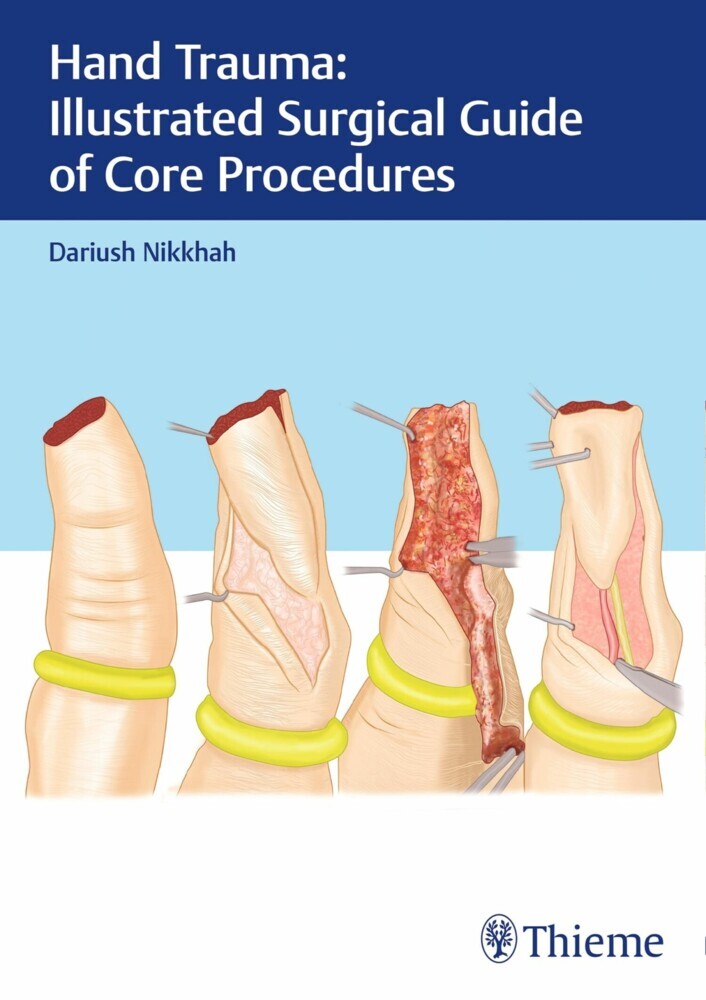 Hand Trauma: Illustrated Surgical Guide of Core Procedures main product photo