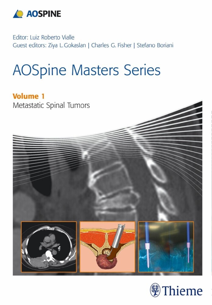 AOSpine Masters Series, Volume 1: Metastatic Spinal Tumors main product photo