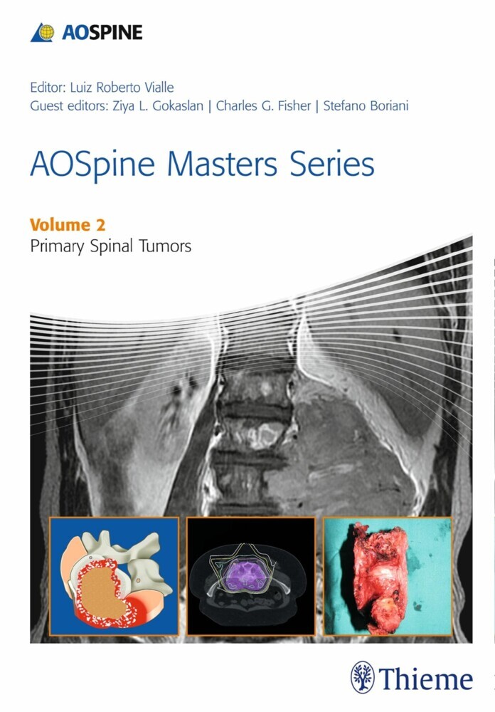 AOSpine Masters Series, Volume 2: Primary Spinal Tumors main product photo