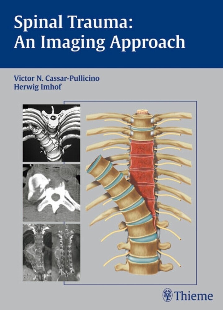 Spinal Trauma - An Imaging Approach main product photo