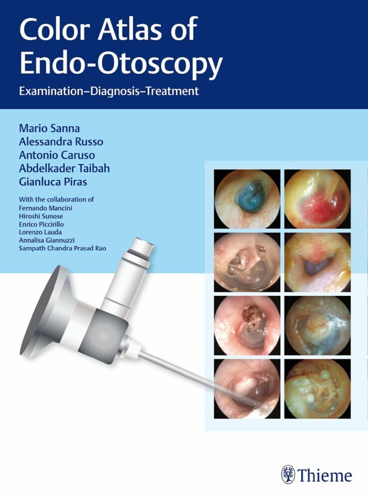 Color Atlas of Endo-Otoscopy main product photo