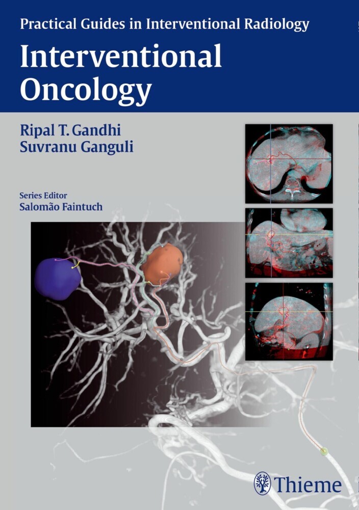 Interventional Oncology main product photo