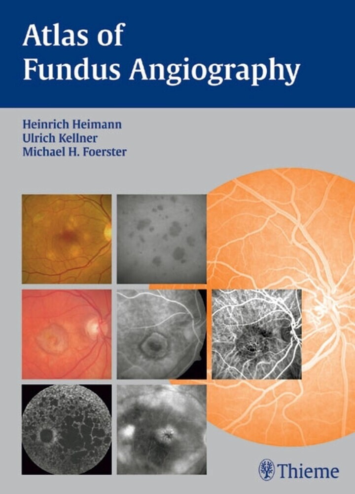 Atlas of Fundus Angiography main product photo