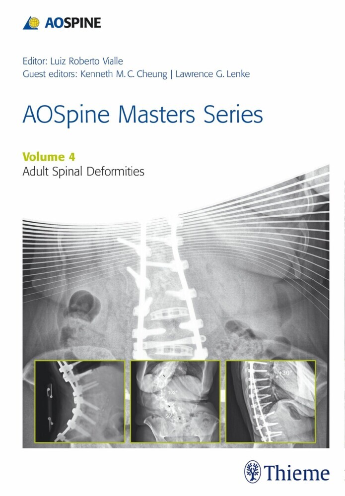 AOSpine Masters Series, Volume 4: Adult Spinal Deformities main product photo