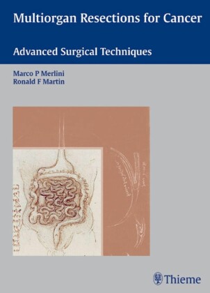 Multiorgan Resections for Cancer