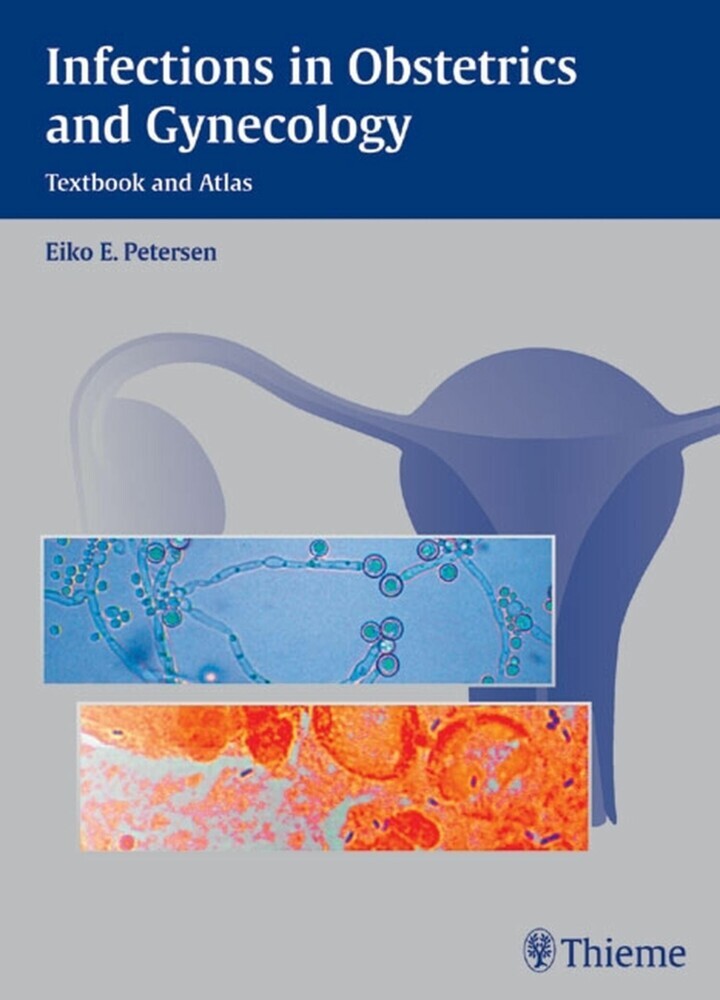 Infections in Obstetrics and Gynecology main product photo