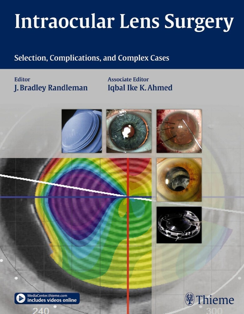 Intraocular Lens Surgery main product photo