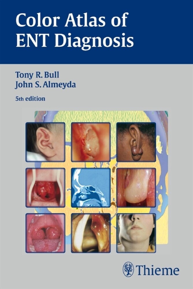 Color Atlas of ENT Diagnosis main product photo