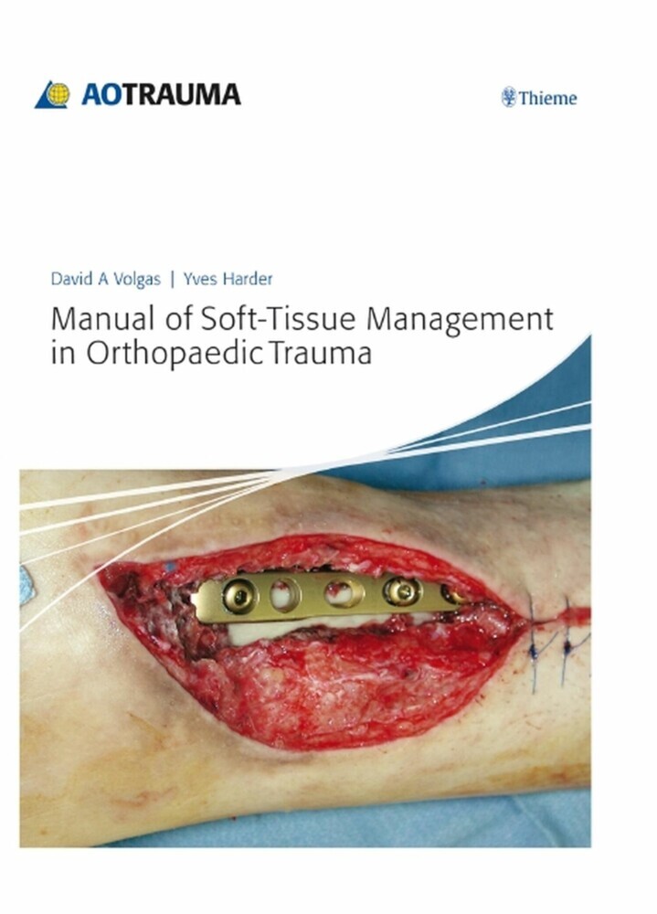 Manual of Soft-Tissue Management in Orthopaedic Trauma main product photo