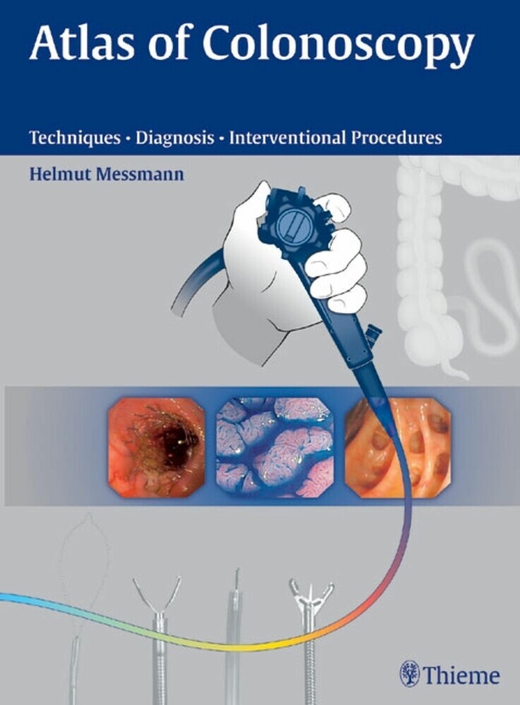 Atlas of Colonoscopy main product photo
