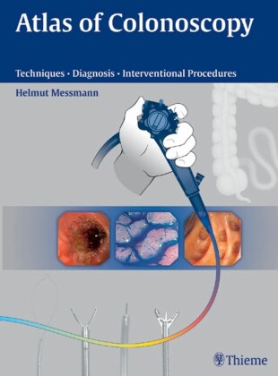 Atlas of Colonoscopy