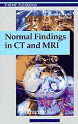 Normal Findings in CT and MRI