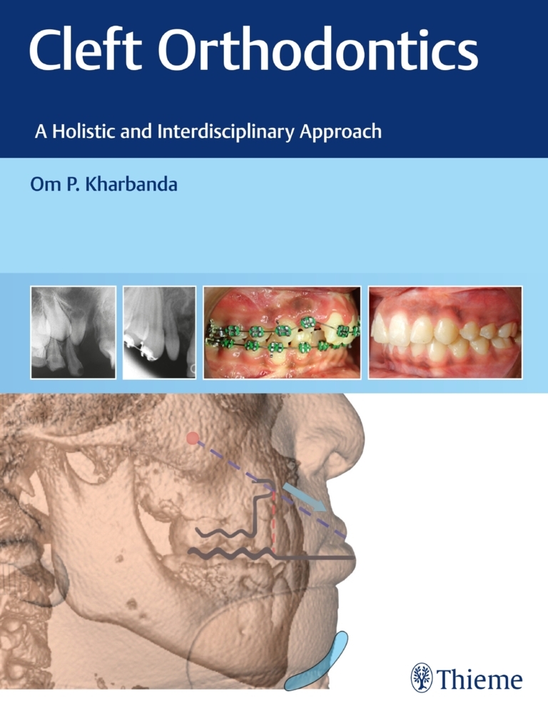 Cleft Orthodontics main product photo