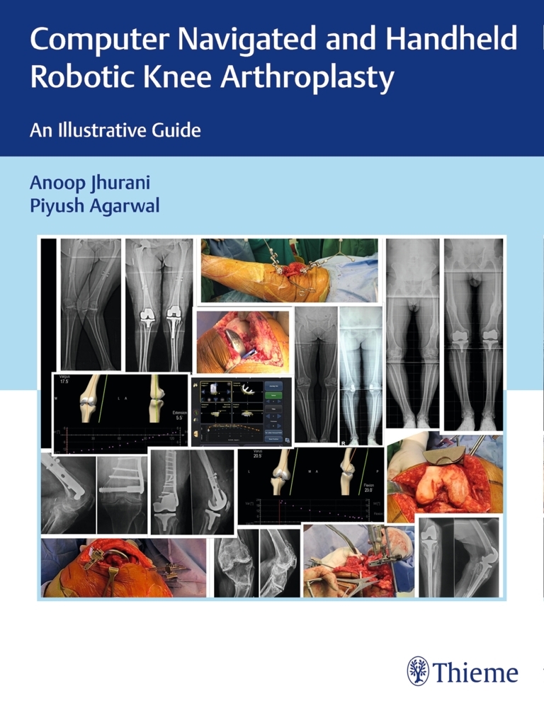 Computer Navigated and Handheld Robotic Knee Arthroplasty main product photo