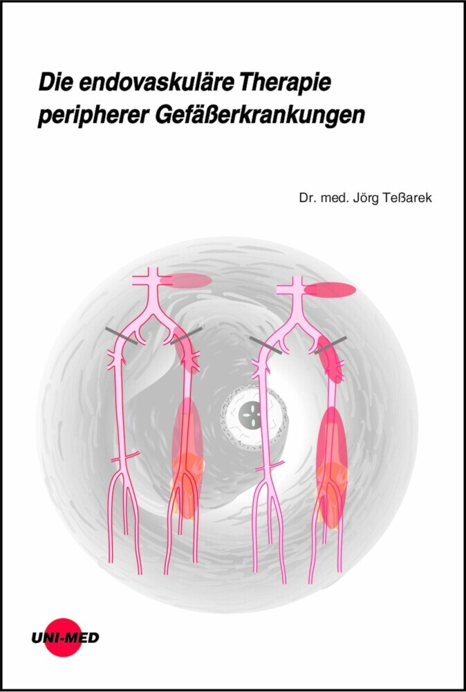 Die endovaskuläre Therapie peripherer Gefäßerkrankungen main product photo