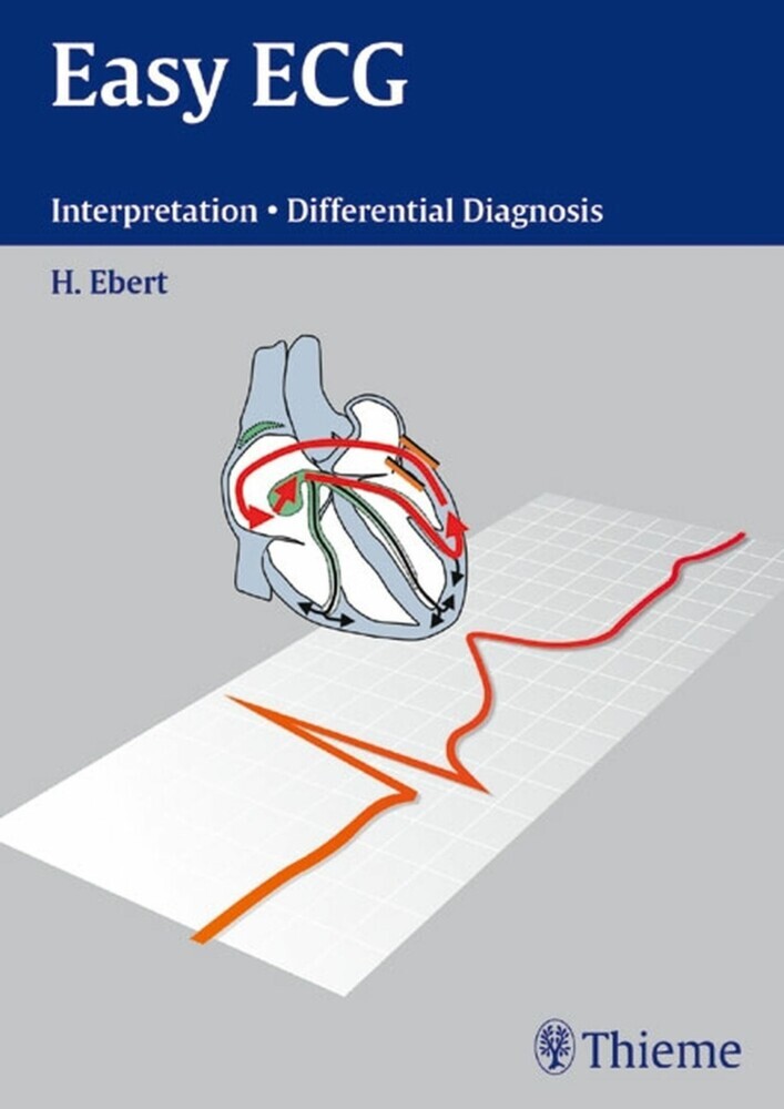 Easy ECG main product photo