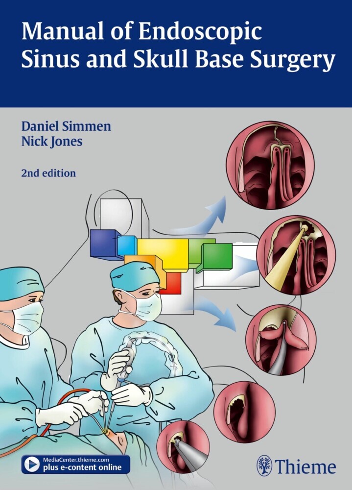 Manual of Endoscopic Sinus and Skull Base Surgery main product photo