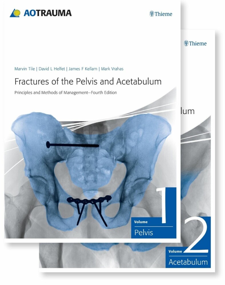 Fractures of the Pelvis and Acetabulum main product photo