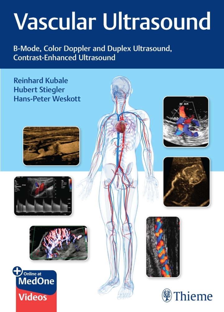 Vascular Ultrasound main product photo