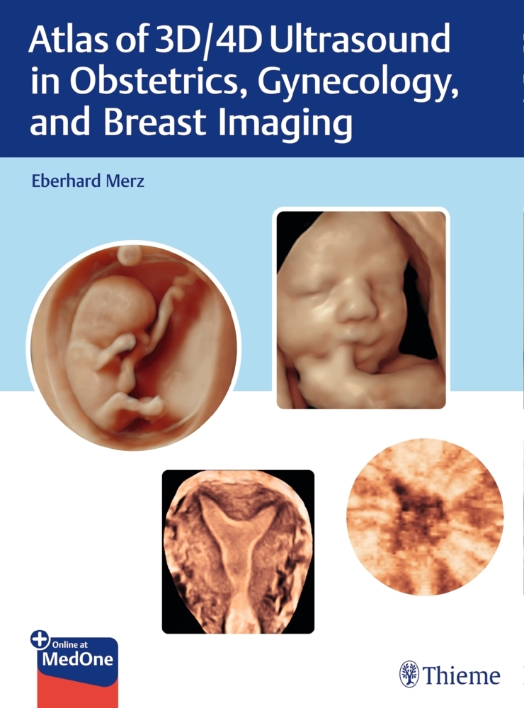 Atlas of 3D/4D Ultrasound in Obstetrics, Gynecology, and Breast Imaging main product photo