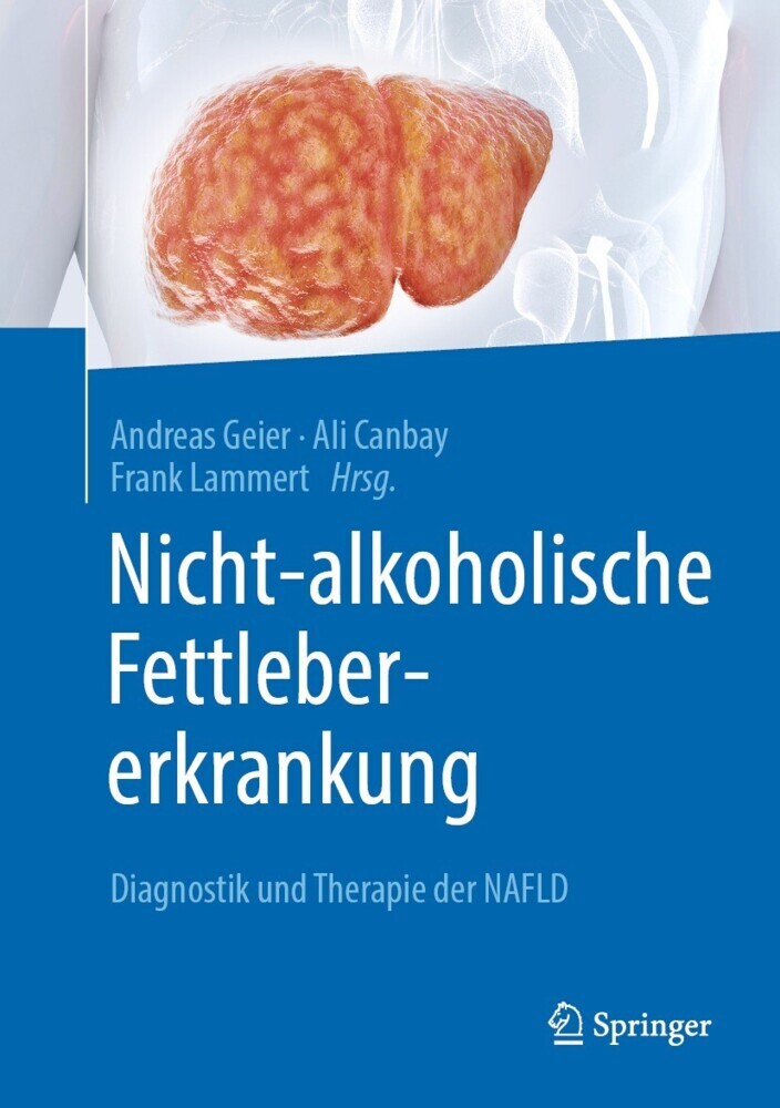 Nicht-alkoholische Fettlebererkrankung main product photo