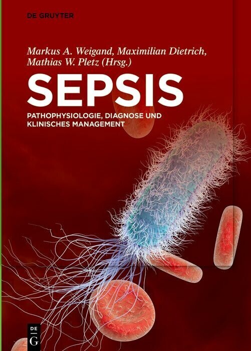 Sepsis main product photo