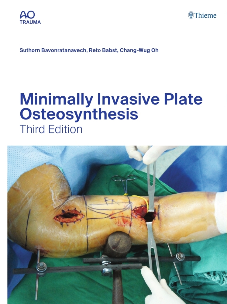 Minimally Invasive Plate Osteosynthesis main product photo