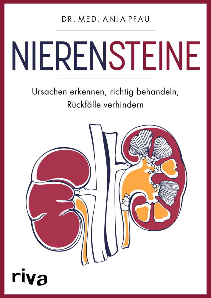 Nierensteine - Ursachen erkennen, richtig behandeln, Rückfälle verhindern main product photo