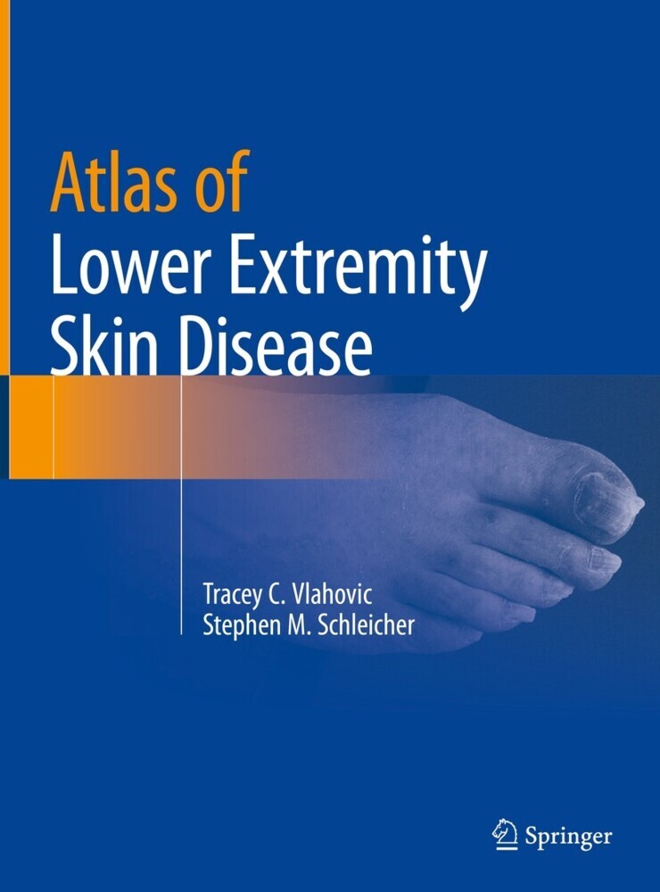 Atlas of Lower Extremity Skin Disease main product photo