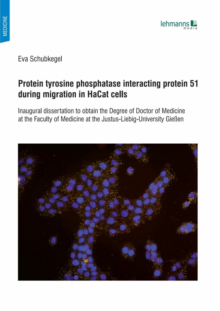 Protein tyrosine phosphatase interacting protein 51 during migration in HaCat cells main product photo