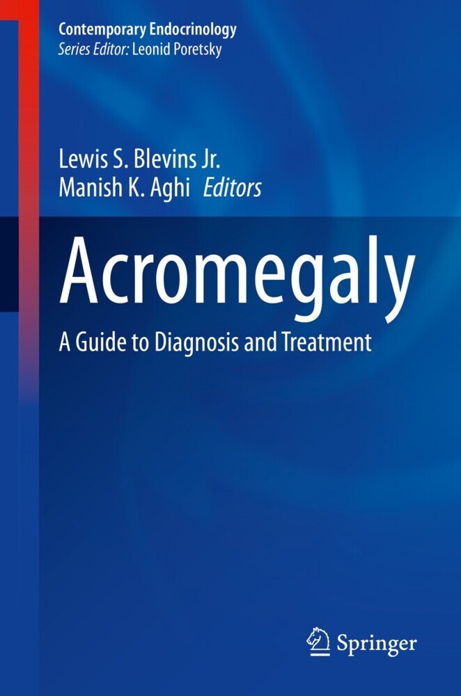 Acromegaly main product photo