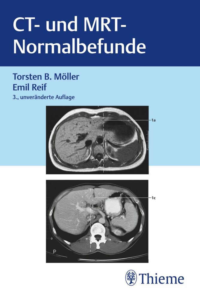 CT und MRT Normalbefunde main product photo