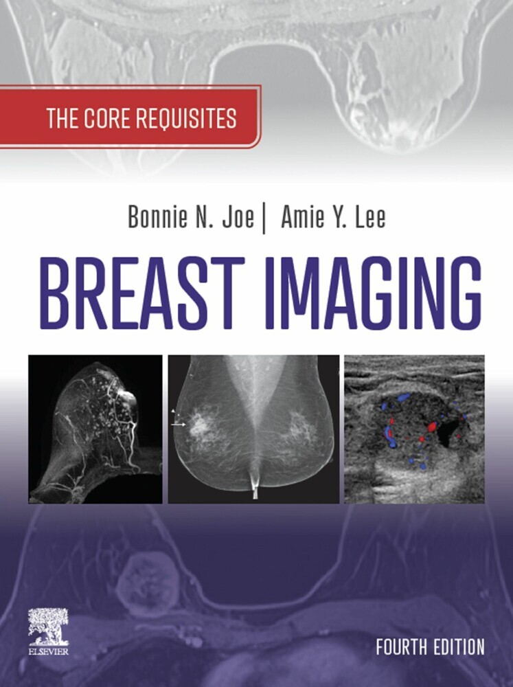 Breast Imaging, E-Book main product photo