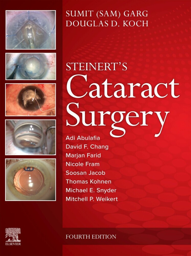 Cataract Surgery main product photo
