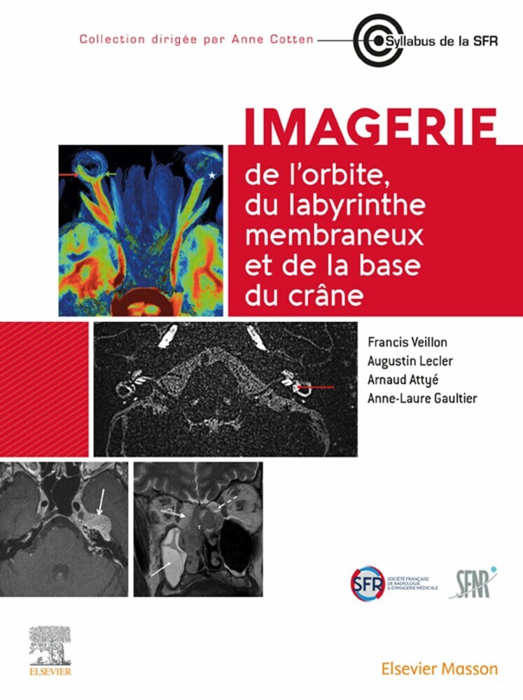 Imagerie de l'orbite, du labyrinthe membraneux et de la base du crâne main product photo