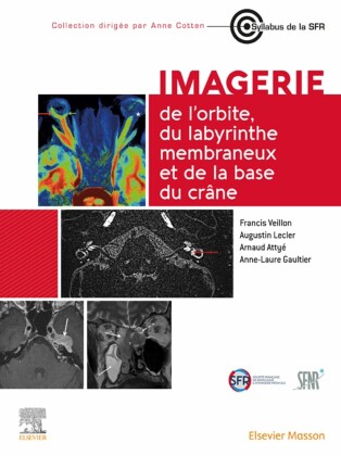 Imagerie de l'orbite, du labyrinthe membraneux et de la base du crâne