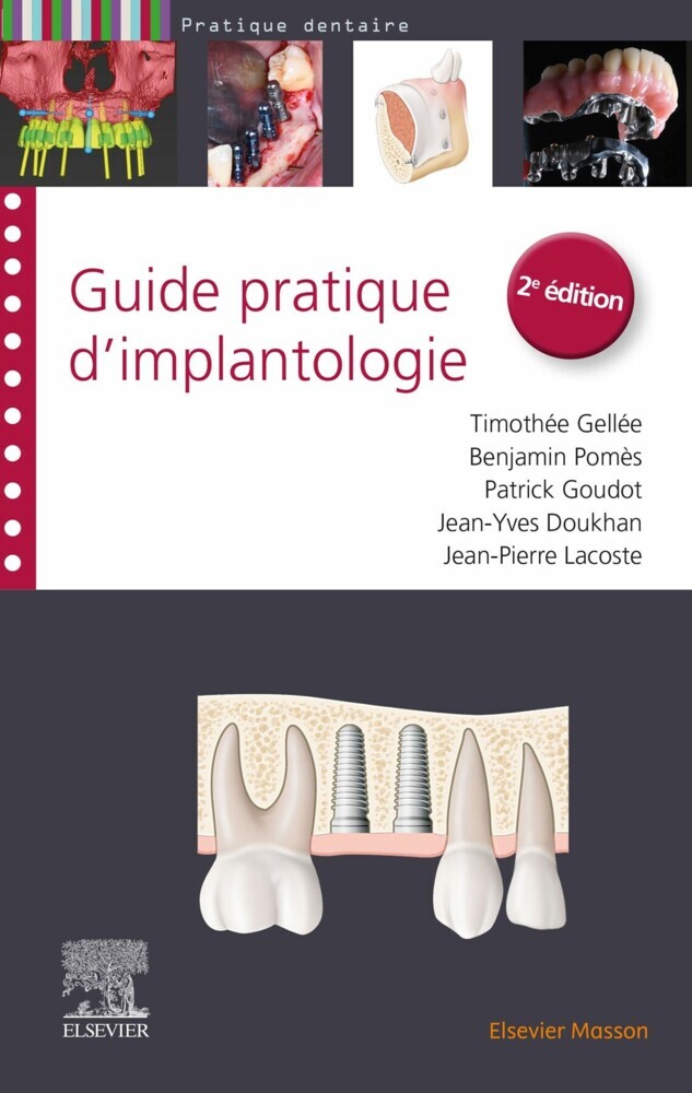 Guide pratique d'implantologie main product photo