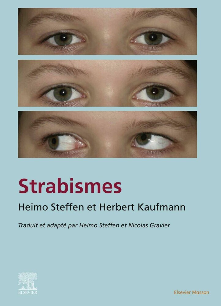 Strabisme main product photo