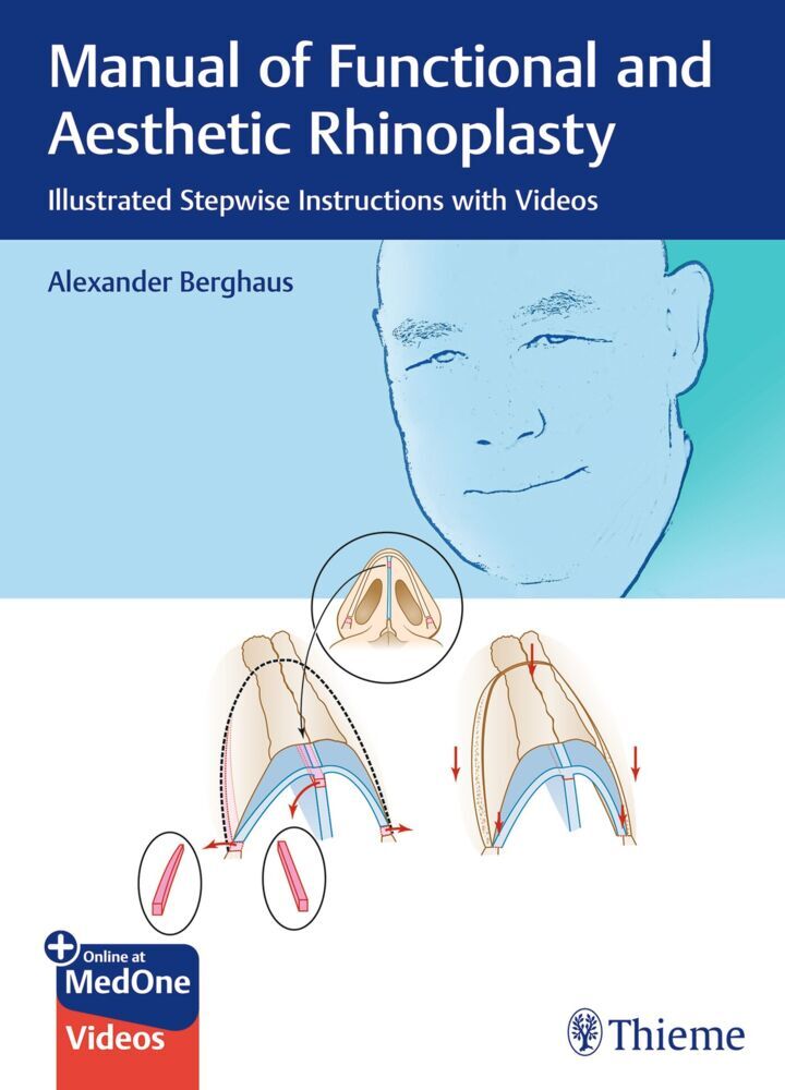 Manual of Functional and Aesthetic Rhinoplasty main product photo