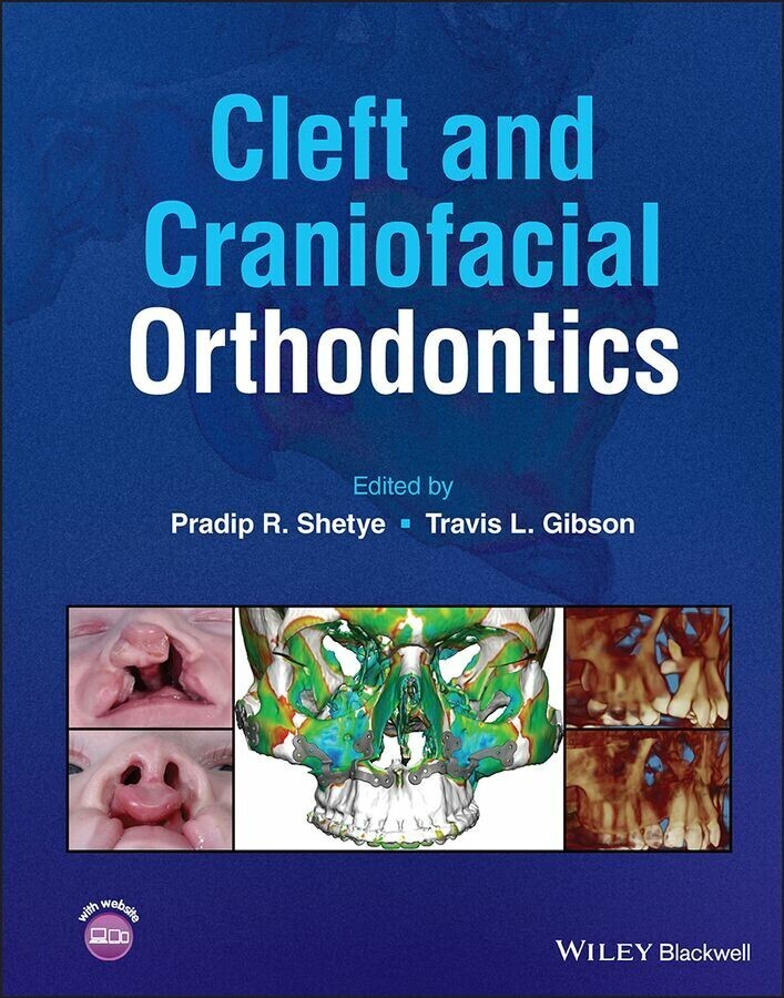 Cleft and Craniofacial Orthodontics main product photo