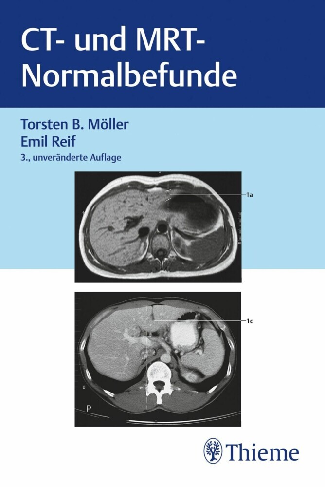 CT und MRT Normalbefunde main product photo